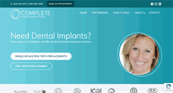 Desktop Screenshot of dentalimplants-perth.com.au